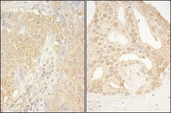 CaMKK alpha Antibody, Novus Biologicals 0.1mL; Unlabeled:Antibodies, Polyclonal